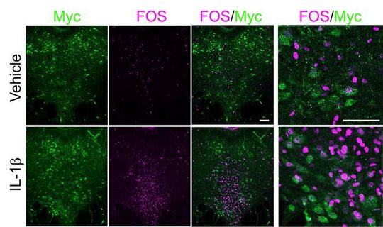 A figure from the paper illustrates that among cells expressing myc (green), a proxy for the IL-1R1 receptor, neural activation is much greater as measured with fos (magenta) when IL-1 beta was administered vs. when a control (vehicle) chemical was.(Source:  Cho Lab/ MIT Picower Institute)