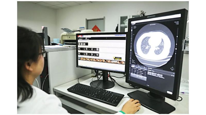 Unternehmen wie Infervision entwickeln Digital-Health-Lösungen mit integrierter KI.(Bild:  InferVision)