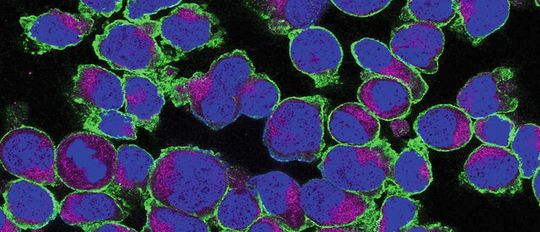 Expression von GLUT3 auf aktivierten T-Zellen. GLUT3 (grün) ist auf der Zelloberfläche lokalisiert, die Mitochondrien (violett) und der Kern (blau) wurden ebenfalls dargestellt. (Bild:  AG Väth/Uni Würzburg)