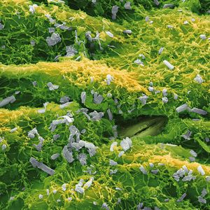 The picture shows crystalline particles of the crop protectant boscalid, which fights fungi in crops such as fruit, vegetables and vines but also in cereals and canola (oil seed rape). Boscalid inhibits cell respiration in the fungi. Boscalid consists of one to 10 micrometer sized particles that are distributed evenly on the leaf surface, forming a protective coating. Magnification 1 200 :1 (12cm in width)