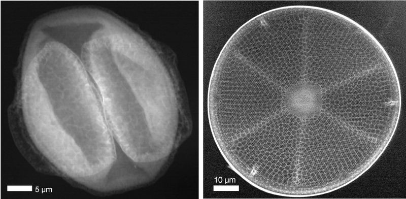 Blütenpollen im Röntgenlicht Ein Pollen mit darin enthaltenem Nanoschaum oder die faszinierenden geometrischen Strukturen im Inneren einer Kieselalge: Mit einer neuen Technik ist es einem Team am deutschen Elektronen Synchrotron DESY gelungen, winzige biologische Proben zu durchleuchten, ohne sie zu beschädigen. Das Verfahren liefert hochauflösende Röntgenbilder von getrocknetem biologischem Material, das zuvor weder eingefroren noch beschichtet oder anderweitig verändert werden muss. Im Bild: Ein bei DESY gesammeltes Pollenkorn (l.) und eine Kieselalge, beide abgebildet mit Compton-Röntgenstreuungsmikroskopie an der Röntgenstrahlungsquelle PETRA III. Diese mikroskopischen Aufnahmen gelangen ohne Beschädigung der Originalproben, indem die Forscher Photonen hoher Energien verwendeten, die durch Speziallinsen stark fokussiert wurden.   Hier gehts zur Originalmeldung Wissenschaftsbild des Tages vom 1.6.2023 (DESY/CFEL)
