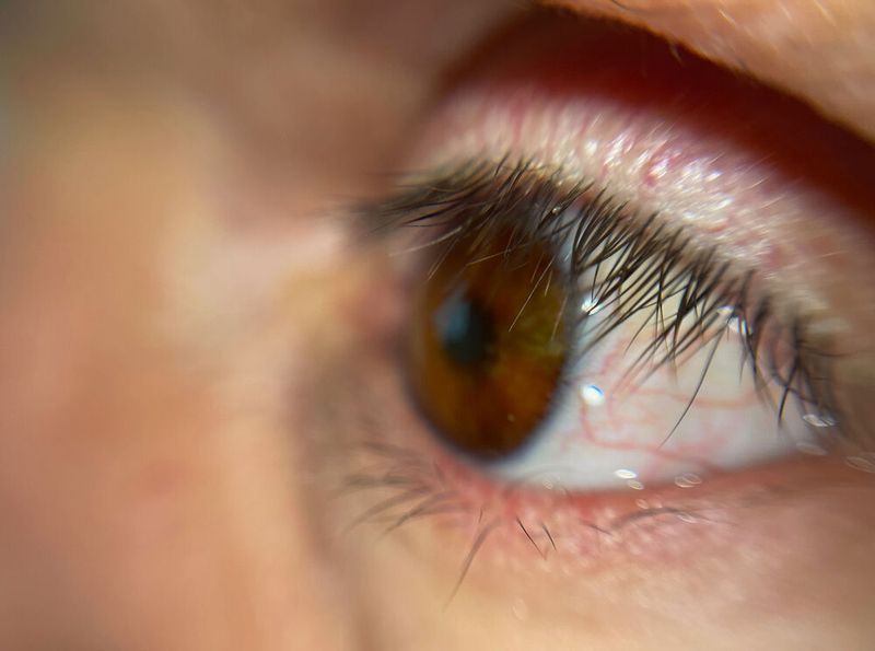 Nahaufnahme der 3D-gedruckten Augenprothese (Bild: Professor Mandeep Sagoo)