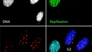 Die fluoreszenzmikroskopischen Bilder von Zellen, in denen das Gen NBS1 inaktiviert wurde, zeigen die DNA im Zellkern, sowie deren Replikation und DNA-Schäden (hiMAC-Analyse). (Bild: Christopher Bruhn / FLI)