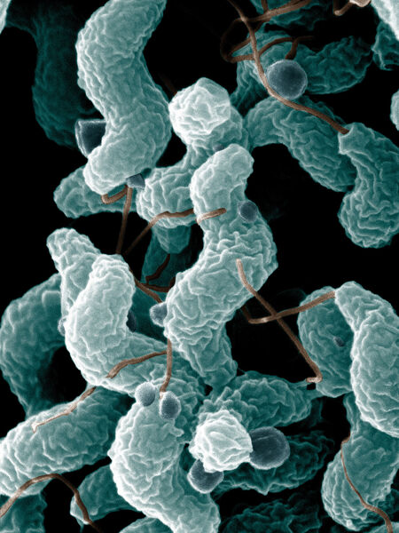 Platz 13: Campylobacter in Lebensmitteln  Die ansteckenden Durchfall-Erreger verunsichern 11 % der Befragten. (Bild: Agricultural Research Service (ARS)) (Photo by De Wood; digital colorization by Chris Pooley)