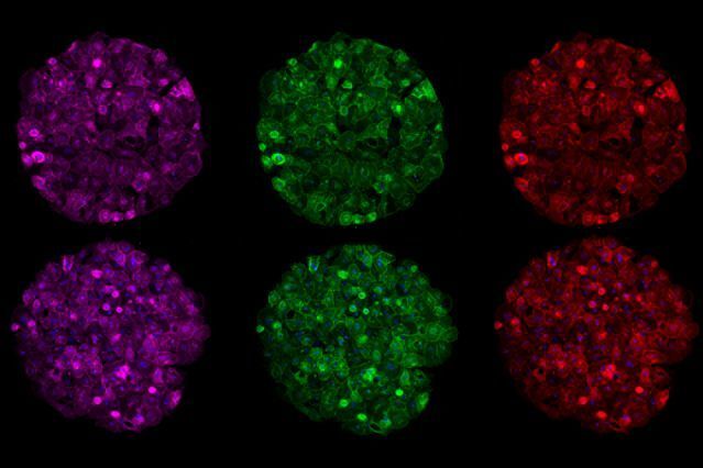 MIT researchers have developed an engineered liver tissue model that can be manipulated with RNA interference (RNAi). (Liliana Mancio-Silva/MIT)