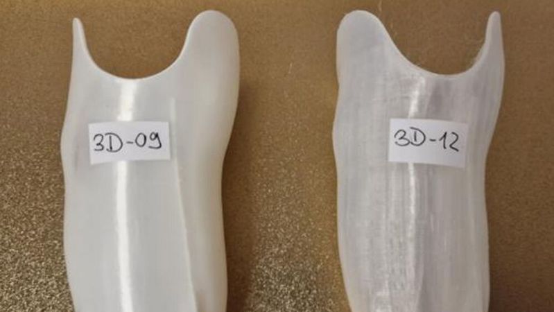 Klingt wie Sciene-Fiction, ist aber real. Prothesen aus dem 3D-Drucker können Versorgungslücken nachhaltig schließen.(Bild:  DOI ortho-innovativ)