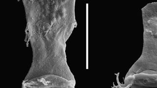 Mikrofossilien wie die circa 420 Millionen Jahre alten Chitinozoen haben aufgrund von Schwermetall-Vergiftungen Fehlbildungen entwickelt. Abb. b zeigt eine gesunde, normale Chitinozoe, für die ein kolben- oder flaschenartiger Hals charakteristisch ist. Der breit auseinander gewucherte „Flaschenhals“ (Abb. a) weist hingegen auf eine Fehlbildung hin. (Ausschnitt) (Bild: Thijs Vandenbroucke)