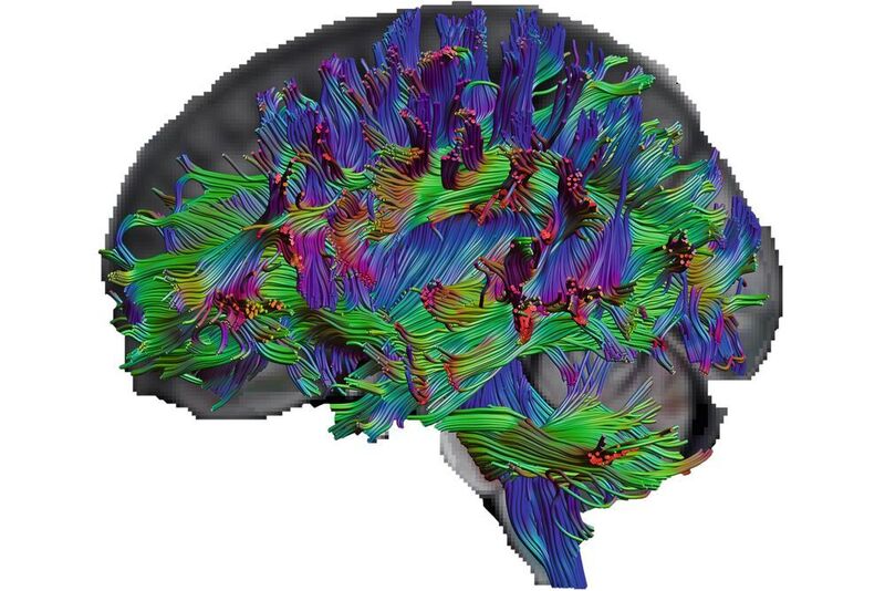 Mit der Diffusions-Tensor-Bildgebung können die ForscherInnen die Nervenfasern im Gehirn sichtbar machen. ( © RUB, Erhan Genç )
