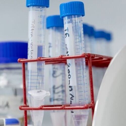 Researchers have discovered a molecular mechanism that regulates whether the cells of an aggressive colorectal cancer are conventional or inverted when they spread in the body. (Source:  Turun yliopiston viestintä/University of Turku Communications)