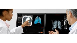AI-Rad Companion Chest CT ist eine auf künstlicher Intelligenz (KI) basierende Software für die Computertomografie (CT). Die zugrundeliegenden Algorithmen wurden in Wissenschaftsteams bei Siemens Healthineers anhand von umfangreichen klinischen Datensätzen trainiert. (Bild: Siemens Healthineers)