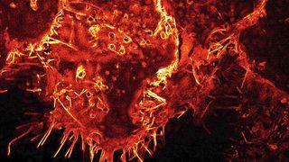 Mikroskopieaufnahme von menschlichen Zellen, die Virosomen produzieren (klicken für Details). (Universitätsklinikum Tübingen)