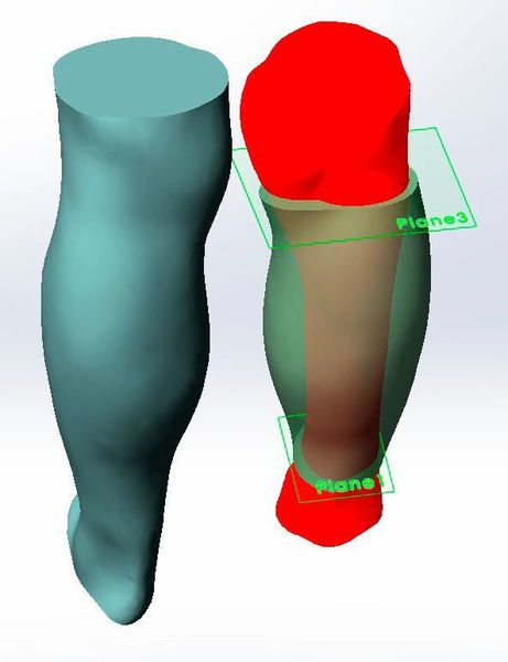 Der nächste Schritt bestand darin, ein solides festes 3D-Modell beider Beine mit Solid Works zu formen. Sobald dies fertig war, wurde das Modell des gesunden Beins gespiegelt; das solide Modell des verletzten Beins wurde dann anhand der Vorlage rekonstruiert und ein Freiraum wurde eingeplant, um der Haut das Atmen zu ermöglichen. (Artec 3D)