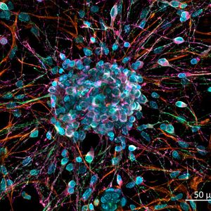 Primäre neuronale Zellen in Kultur. Dekonvolvierte Z-Stapel Projektion mit GPU-basierter Dekonvolution. Antikörper-Färbung von Klasse III beta-Tubulin (Cy2), Nestin (Cy3) und DCX (Cy5). Kerne mit DAPI-Färbung. Probe bereitgestellt von H. Braun, LSM Bioanalytik GmbH, Magdeburg, Germany.