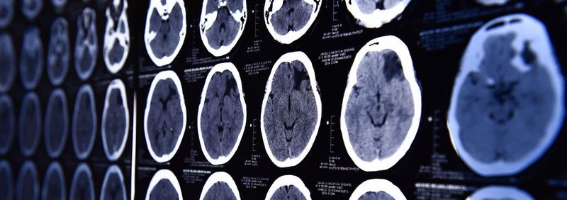 Bildgebende Verfahren wie die Computer-Tomographie (CT) erlauben tiefe Einblicke in den menschlichen Körper und sind mitunter für die Diagnostik unerlässlich. Nachteil sobald Röntgenstrahlen ins Spiel kommen: Die Strahlenbelastung für den Körper der Patienten. (Symbolbild)(Bild:  nimon_t - stock.adobe.com)