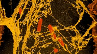 Mikroskopaufnahme von Bakterien (rot), die in einem Netzwerk von Proteinen festgehalten werden.  (Bild: HZI)