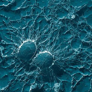 (Bild: Usda Ars Emu)