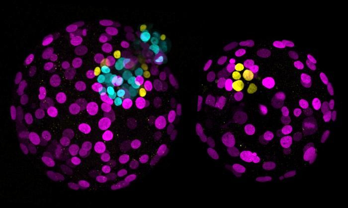 Genediting in der Embryonalentwicklung   Forschende der University of Cambridge haben erstmals eine Genediting-Technik eingesetzt, um die Funktion eines einzelnen Gens in menschlichen Embryonen zu untersuchen. Die Methode namens Base-Editing ist eine präzisere Weiterentwicklung der bekannten CRISPR/Cas9-Technik. Sie kann ein einzelnes Nukleotid-Basenpaar innerhalb eines menschlichen Genoms von rund drei Milliarden Basenpaaren verändern. Ein besseres Verständnis von der Funktion einzelner Gene könnte dazu beitragen, die Erfolgschancen der In-vitro-Fertilisation zu verbessern.  Das Bild zeigt: Links ein normaler Embryo (magentafarbene Zellen entwickeln sich zur Plazenta, gelbe zum Dottersack und türkise zum Epiblasten, aus dem später der Körper entsteht) und rechts ein Embryo, bei dem das sogenannte NANOG-Gen durch Genediting blockiert wurde (türkise Zellen fehlen vollständig – der Epiblast konnte sich nicht entwickeln)   Hier geht‘s zur Originalmeldung Wissenschaftsbild des Tages vom 7.7.2026  (Bild: Loke Centre for Trophoblast Research, University of Cambridge)
