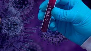 Um schnell einen geeigneten Wirkstoff gegen das Coronavirus Sars-Cov-2 zu finden, testen akademische Einrichtungen weltweit an Zellkulturen die Wirksamkeit zugelassener Arzneimittel. (gemeinfrei)