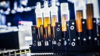 Blutproben im Labor (Symbolbild). (Bild: DZNE/Haagman)