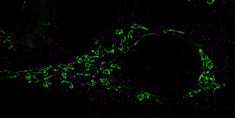 Fragmentierung von Mitochondrien (grün): Die für den Zerfall verantwortlichen Drp-1-Proteine sind mit Antikörpern markiert und in Magenta gefärbt.