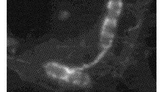 Verfahren zur quantitativen Auswertung von Mikroskopbilddaten, Mikroskop und Softwareprodukt. (DPMA)