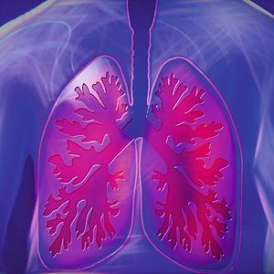 Lungenfibrose ist eine Lungenkrankheit, bei der das Gewebe der Lunge vernarbt.  Atembeschwerden sind die Folge. (Symbolbild)