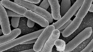 Rastertunnelmikroskopaufnahme von einer Kultur Escherichia Coli (Quelle: NIAID)
