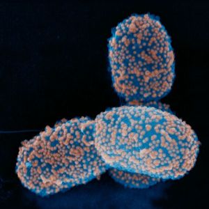 Auch so können Roboter aussehen: Diese Bakterien sind mit magnetischen Nanopartikeln ummantelt, so dass sie sich mittels Magneten durch die Blutbahn an eine bestimmte Körperstelle lotsen lassen.(Bild:  Stephan Handschin / ScopeM, ETH Zürich)