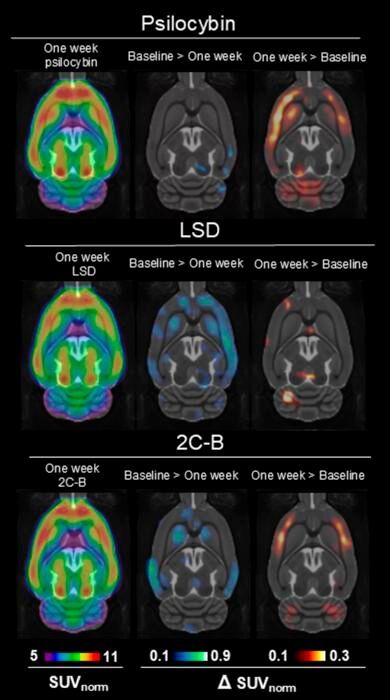 Long term effects as seen in brain scans on rats(Source:  Mikael Palner/ University of Southern Denmark)