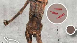 MicroRNAs zeichnen sich durch eine sehr hohe Stabilität aus. In der Gletschermumie Ötzi blieben sie über Jahrtausende hinweg konserviert. (Ausschnitt) (© Andreas Keller/ Universität des Saarlandes)