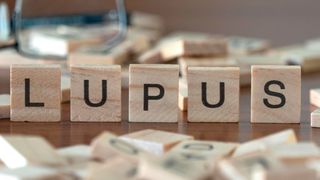 Systemischer Lupus erythematodes („Roter Wolf“), kurz „SLE“, ist eine schwere Form einer Autoimmunerkrankung, die meist bei junge Frauen auftritt und bei der sich Antikörper gegen die eigene Erbsubstanz (DNA) bilden.  (Bild: lexiconimages - stock.adobe.com)