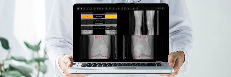 Mit künstlicher Intelligenz will ein Wiener Start-up Knochen- und Gelenkerkrankungen diagnostizieren. Mit künstlicher Intelligenz will ein Wiener Start-up Knochen- und Gelenkerkrankungen diagnostizieren.