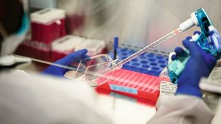 Das Arbeiten mit Zellkulturen soll zukünftig für die junge Wissenschaftler tierfrei werden. Im Laborkurs „Nukleinsäuretechnologien“ der TU Berlin werden daher bereits  die Zellen in einem tierfreien Nährmedium kultiviert. (Symbolbild) (Bild: frei lizenziert/ National Institute of Allergy and Infectious Diseases)