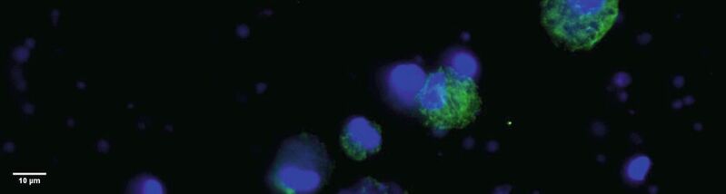 Abb. 1: Dendritische Zellen von der Katze; Doppelfärbung (DAPI und mouse anti-cat MHC II/goat-anti-mouse-FITC) zur Quantifizierung MHC-II-positiver Zellen