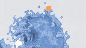 Pseudokoloriertes Elektronenmikroskopiebild einer Makrophage (blau), die Mikroplastik (orange) aufnimmt. (Bild: Mass Lab/Uni Bonn)