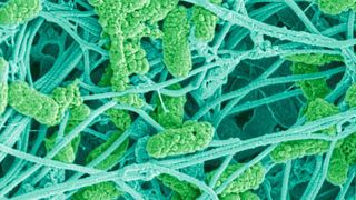 Wundkeime (Pseudomonas aeruginosa, hellgrün) zwischen Bindegewebsfasern von menschlicher Haut (blau-grau) (Rasterlektronenmikroskopie, koloriert).  (Bild: Empa)