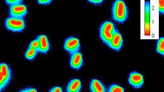 Fluoreszierende Sensorbakterien, helfen den Forschenden dabei, antimikrobielle Peptide wie Bacteriocine zu detektieren. Die Fluoreszenzmikroskopischen Aufnahmen zeigen einzelne Bakterien. Bei Kontakt mit dem Bacteriocin leuchten die Sensorbakterien im Außenbereich blau-grün. (Bild: Christian Riedel / Uni Ulm)