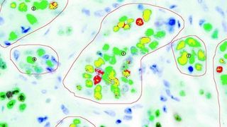 Das CRi Nuance ein Systemermöglicht in der Hellfeldmikroskopie spezifische vierfach- und fünffach-Färbungen plus Counterstain.  (Bild: L.O.T.-Oriel)