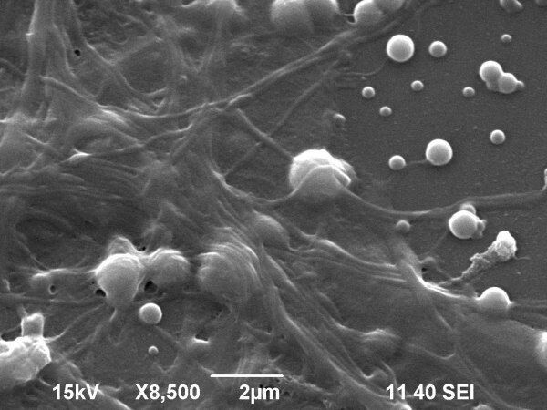 Scanning electron microscopy image showing detail of the neural network on a layer of nanoparticles. (University of Granada)