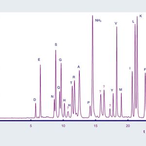 Abb.1: Aminosäurenanalyse in der Onkologie – Biopsie von Kolonzellgewebe. Stationäre Phase: Watrex Amino Acid - AQC 5 µm; Säule: 250 x 4 mm mit 20 x 4 mm Vorsäule; Eluent A: 100 mM Na-Acetat-Puffer pH 6,4; Eluent B: 70% ACN/Wasser = 60/40 30%; Gradient: 5–18% B (0–4 min), 18–19% B (4–10 min), 19–35% B (10–16 min), 35–40% B (16–24 min); 40–60% B (24–31 min); Flussrate : 1,5 mL/min; lin. Fluss: 1,99 mm/sek; Druck: 20–24 MPa; Temperatur: 37 °C; Detektion(Fl): 254 exc.–395 em; Flusszelle: 16 mL.; Injektion:
16 µL; Probe: Extrakt von Kolonzellgewebe