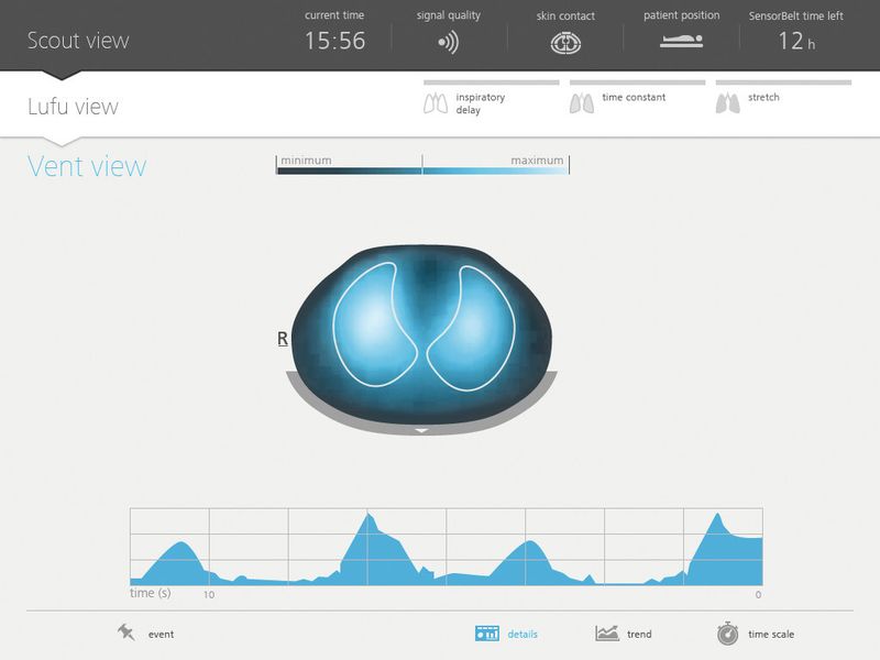 Mit der Vent-View können Nutzer das Atmen in einer Live-Ansicht beobachten. (Bild: Swisstom/User Interface Design)