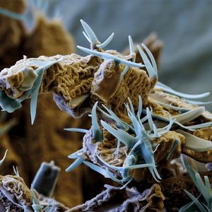 A view into the catalysis microcosm: scanning electron microscope image of a ligand 