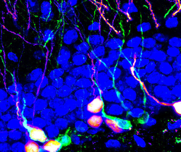 New adult-born neurons that contribute to memory and emotion regulation.  (Song Lab, UNC)