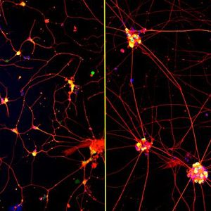 Fluorescent images of human neurons (stained with red, green and blue) growing on coatings with fast-moving molecules (left) or conventional laminin (right) for 72 hours. Neurons attached and spread homogenously on the highly mobile coating but remained clumped together on the laminin coating.(Source:  Northwestern University)