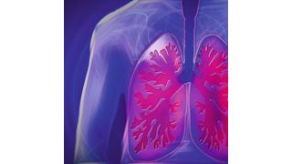 Lungenfibrose ist eine Lungenkrankheit, bei der das Gewebe der Lunge vernarbt.  Atembeschwerden sind die Folge. (Symbolbild) (Pixabay/kalhh)