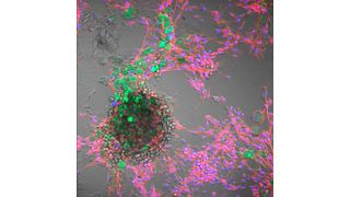 Kombinierte Hellfeld- und Fluoreszenzmikroskopie von Rinderzellen: Zellkerne (blau, DAPI), Cytoskelett (rot, Phalloidin) und aufgenommene Polystyrol-Nanoplastikpartikel (grün, 100 nm). (Bild: FBN)