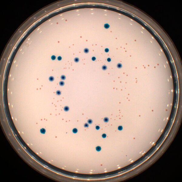 Verdünnungsreihen von Anreicherungskulturen auf selektivem Vibrio Chromagar. Die türkis-farbigen Kolonien sind ein Indikator für Vibrio vulnificus oder Vibrio cholerae, die aus einer Mikroplastipartikel-Probe aus der Nordsee stammen. (Alfred-Wegener-Institut / Antje Wichels)