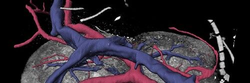 Die Forscher können dank der 3D-Aufnahmen das System von Lymphknoten und deren Blutgefäßen nun besser verstehen.