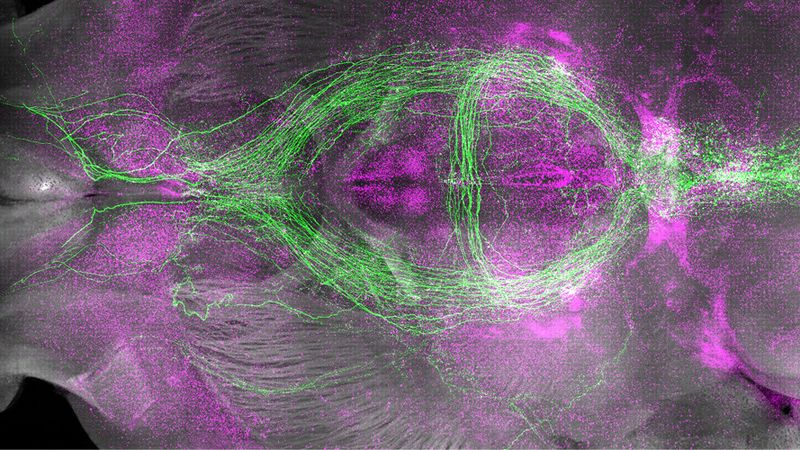 Schlaffördernde Neuronen (grün) und kürzlich aktivierte Neuronen (magenta) im Mausgehirn. (Bild:  William Joo, Biozentrum, Universität Basel)
