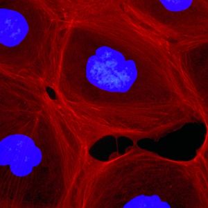Abb. 1a Fluoreszenzmikroskopische Aufnahmen des Effektes von Chivosazol F (12, 50 ng/mL) auf die F-Actin Organisation in Hautkrebszellen des Typs A 431: vor der Behandlung. F-Actin ist mit Phalloidin (rot) und die Zellkerne mit DAPI (blau) gefärbt.